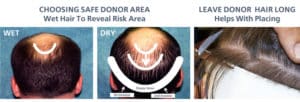 Dry Area for safe donor | Shapiro Medical Group | Minneapolis, MN