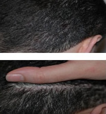 Hair Loss Image 19-38