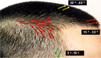follow normal angle and direction of hair