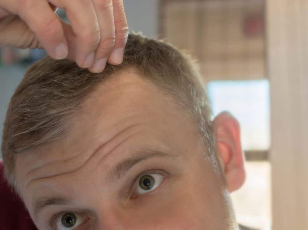 Young man examining his hair while standing indoors, with a focus on his scalp. He is using his fingers to part his hair, possibly checking for thinning or hair loss. The background features natural light coming through a window, highlighting the man's facial features and expression of concern. This image conveys themes of personal grooming, hair health, and self-care.