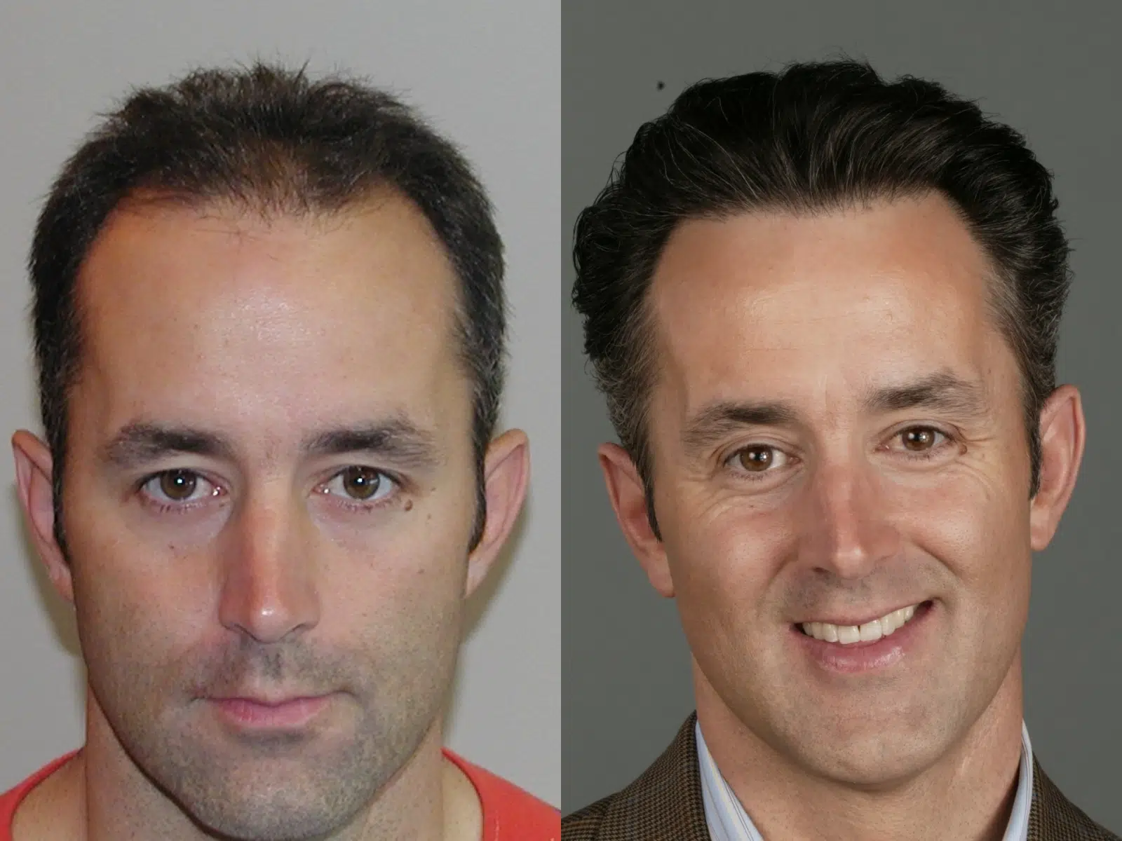 Image comparison showing two male individuals side by side. The left image features a man with short, dark hair and a neutral expression, while the right image depicts the same man with a more polished appearance, sporting a suit and smiling. This visual illustrates the transformation in grooming or styling, emphasizing the impact of professional attire and demeanor on overall presentation. Ideal for discussions on personal branding, professional development, or the importance of appearance in various settings.