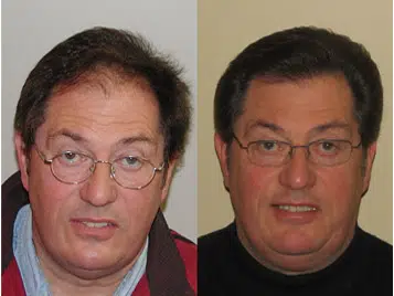 Image shows two side-by-side portraits of a middle-aged man. On the left, he has a slightly disheveled appearance with tousled hair and glasses, displaying a neutral expression. On the right, he appears more polished with styled hair and a friendly smile, wearing a dark sweater. The background in both images is neutral, emphasizing the changes in his appearance. This comparison may illustrate a transformation or improvement in personal grooming or style. The image can be relevant for discussions on personal development, make