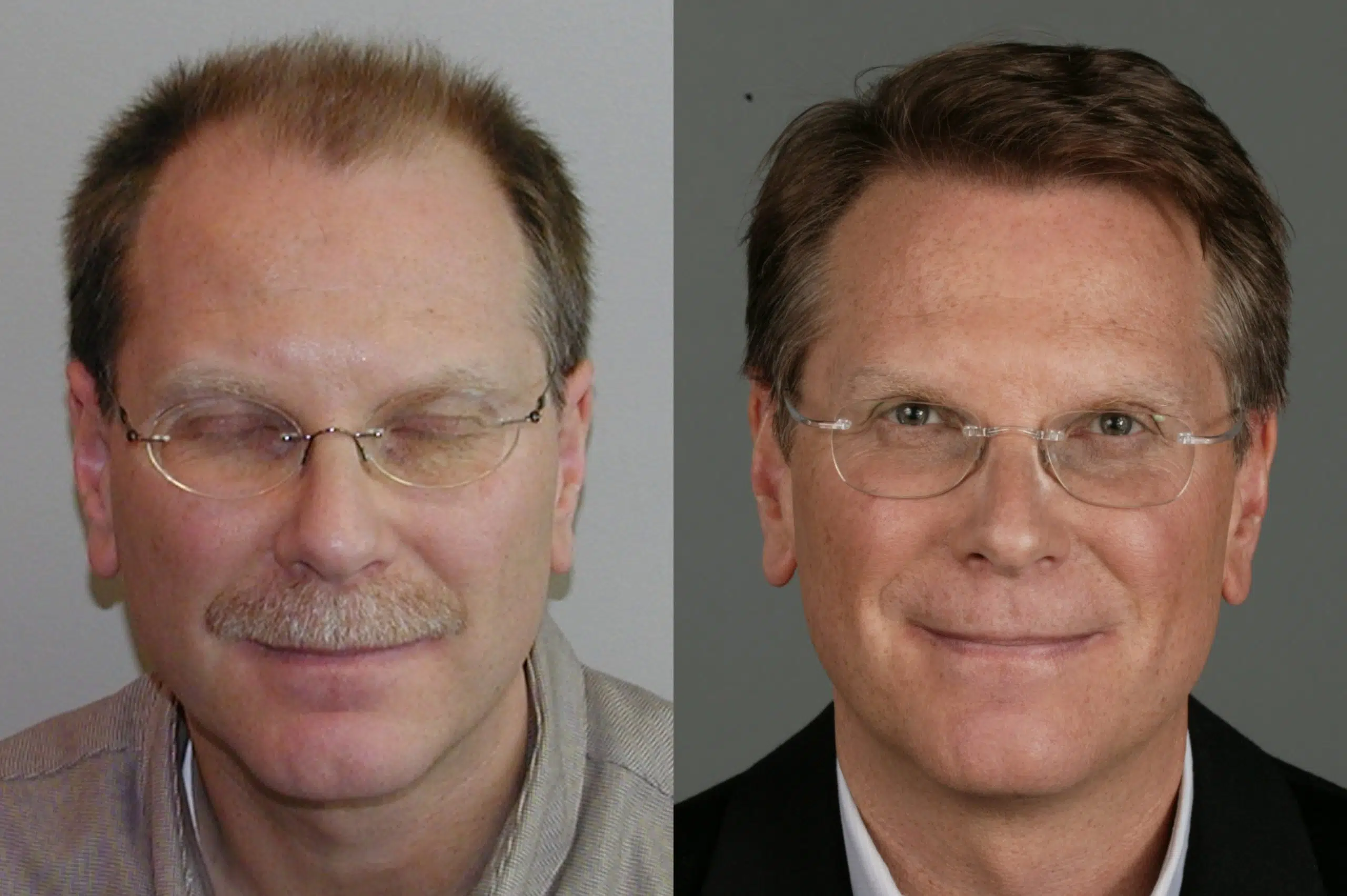 Before and after transformation of a middle-aged man, showcasing significant changes in appearance. The left side features a casual look with a mustache and glasses, while the right side presents a polished appearance in a suit and tie, indicating a professional or formal setting. Both images highlight the same individual, emphasizing the contrast in style and grooming. This visual comparison can be used to illustrate themes of personal growth, transformation, or professional development.