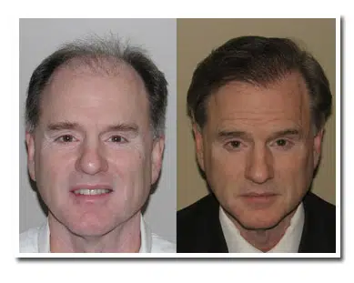 Image comparison showing two photographs of the same man. The left photo features a smiling individual with short, thinning hair, while the right photo presents a more serious expression with neatly styled hair. The background of the left image is light, and the right image has a darker background. This side-by-side comparison highlights changes in appearance and expression, possibly indicating different contexts or emotional states. The images can be used to discuss themes of aging, identity, or the impact of presentation in various settings.