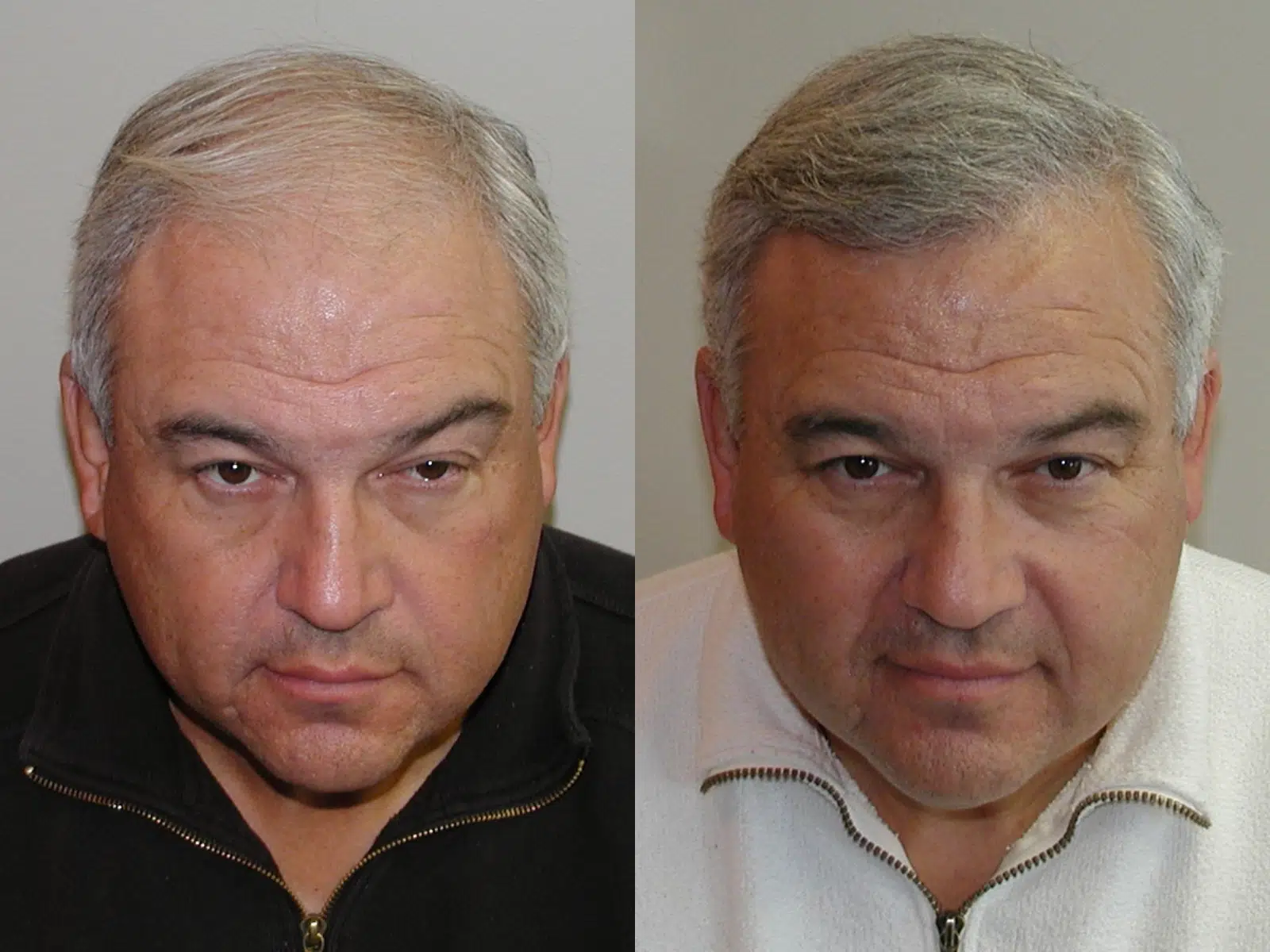 Before and after images of a middle-aged man showcasing a transformation. The left image features the man with gray hair and a serious expression, wearing a black zip-up jacket. The right image shows the same man with a slightly softer expression and styled hair, wearing a white zip-up jacket. This comparison highlights changes in appearance, possibly related to grooming or styling, emphasizing the impact of personal care on overall presentation. The images serve as a visual reference for discussions on aging, grooming techniques, or personal transformation journeys