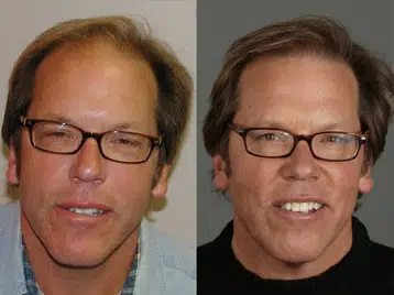 Two side-by-side images of a man with light brown hair and glasses. The left image features him with a casual shirt and a neutral expression, while the right image shows him smiling, wearing a black shirt. Both images highlight his facial features, including his glasses and hairstyle. This comparison may illustrate a transformation or different moods, emphasizing the importance of expression in photography.