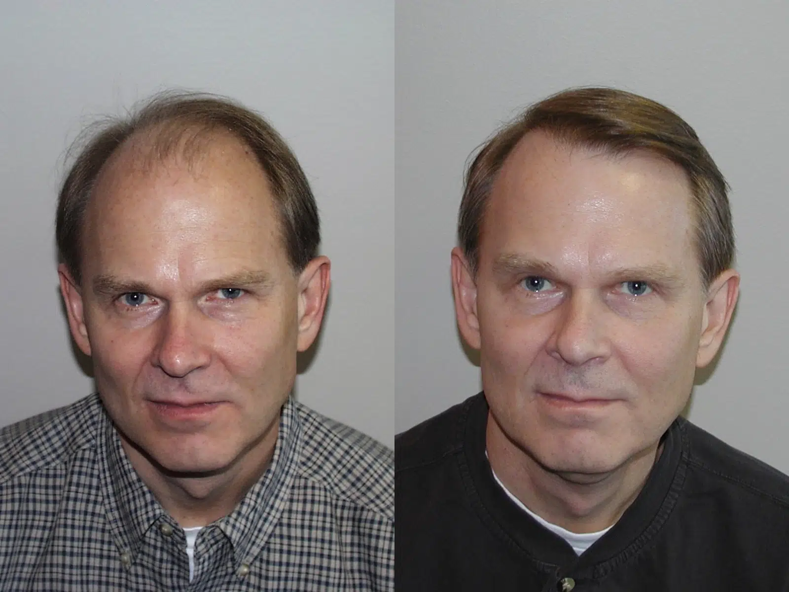 Image showing two side-by-side headshots of a man, one taken with a neutral expression and the other with a slight smile. The left image features the subject wearing a checkered shirt, while the right image shows him in a dark-colored shirt. The background is a plain, light color. This image may be used in a context discussing facial expressions, portrait photography, or identity verification.