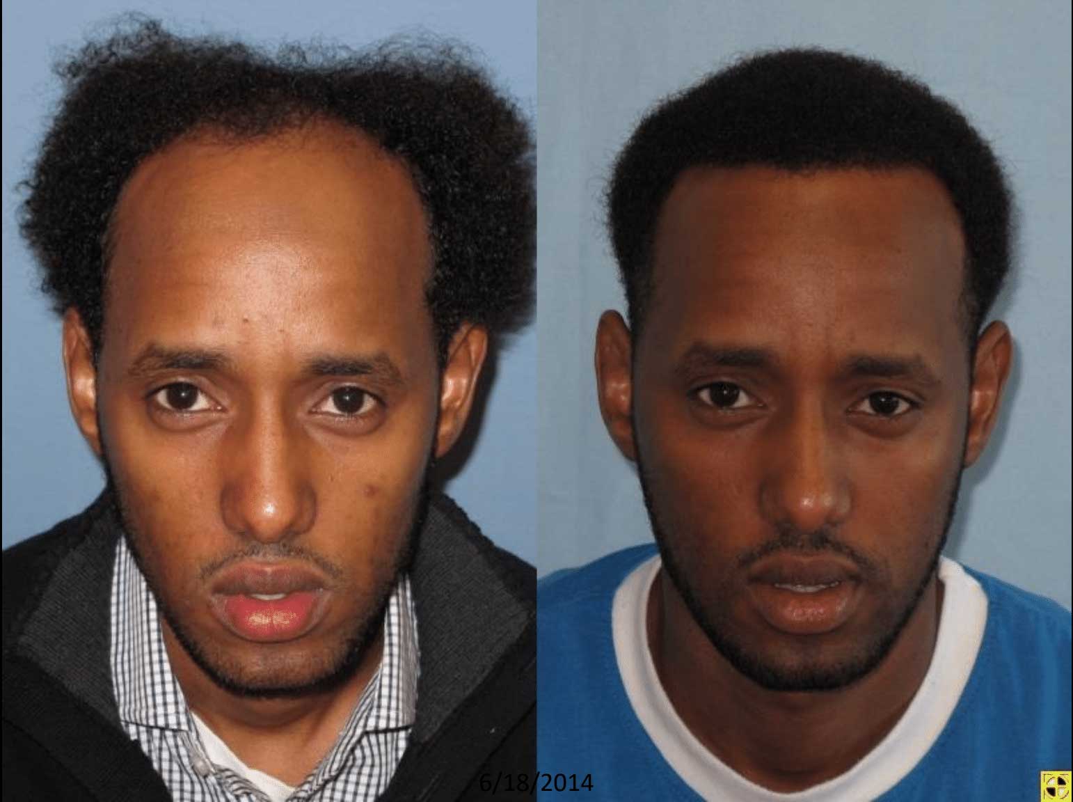 Image shows two side-by-side photographs of a male subject. The left photo depicts the individual with unkempt hair and a neutral expression, while the right photo shows him with a more polished hairstyle and a serious expression. The background of both images is a plain blue, emphasizing the subject's face. This comparison highlights a transformation in appearance, possibly reflecting a change in circumstances or personal grooming. Ideal for discussions on personal change, identity, or criminal justice contexts.
