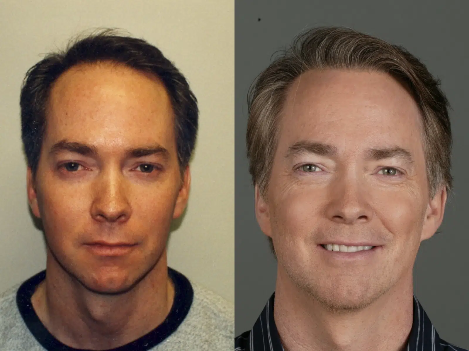 Image comparison showing two headshots of the same man. The left image features a younger man with a neutral expression, while the right image shows the same man with a confident smile and a more polished appearance. The background of the left image is plain, whereas the right has a darker, professional backdrop. This visual highlights the transformation in appearance, potentially indicating changes in personal style or grooming over time. Ideal for discussions on personal growth, self-improvement, or the impact of professional image.