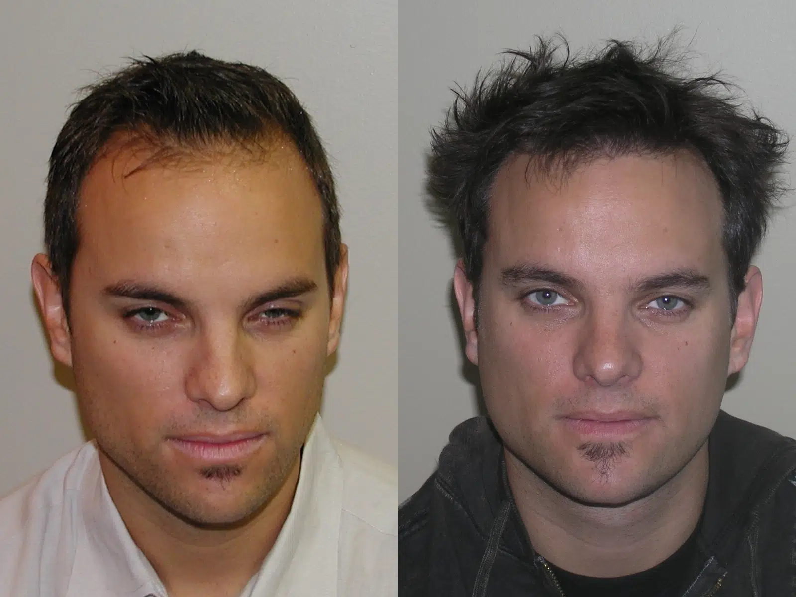 Image showing two side-by-side headshots of a man. The left image features him with short, neatly styled hair and a serious expression, wearing a light-colored shirt. The right image shows a more casual look with slightly tousled hair and a darker outfit, maintaining a neutral expression. The background is plain and focuses on the subject's face, highlighting the differences in hairstyle and attire. This visual comparison can be used to discuss changes in appearance or style over time.
