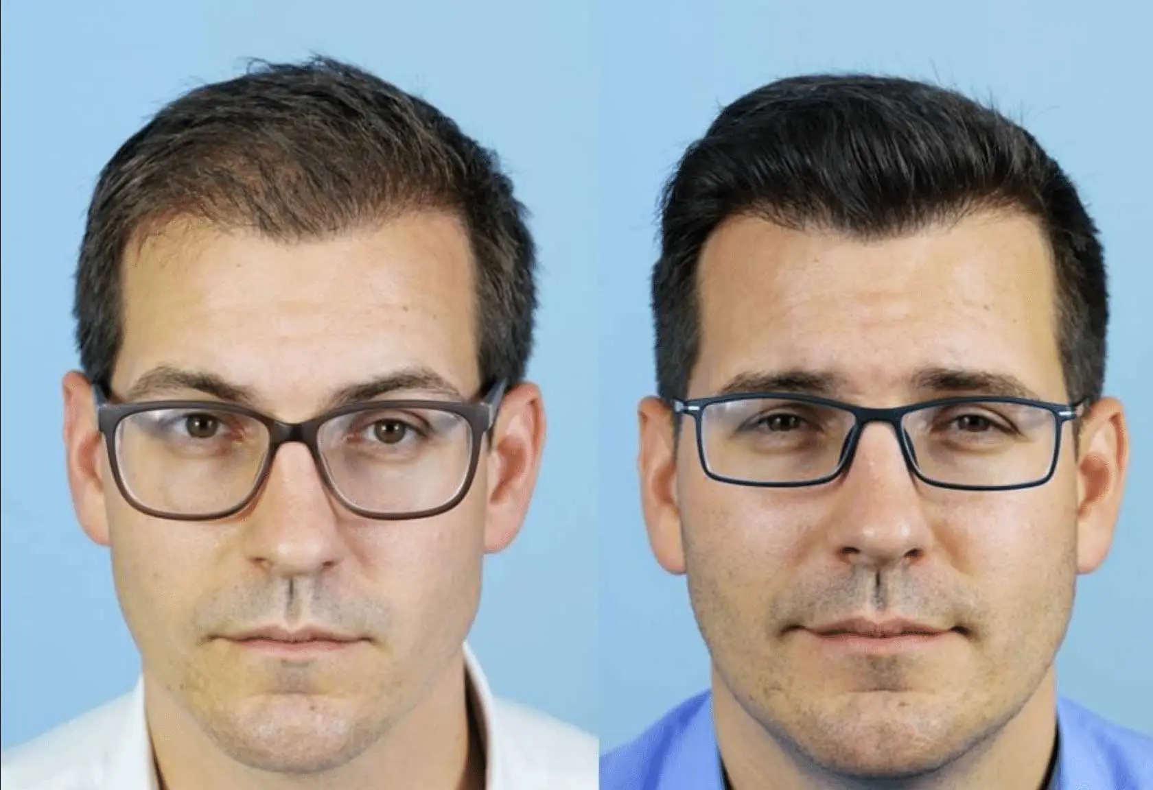 Two side-by-side portraits of a man wearing glasses. The left image shows him with a slightly tousled hairstyle, while the right image features a more polished hairstyle. Both images have a light blue background, highlighting the subject's facial features. The man appears to have a neutral expression, emphasizing the differences in hairstyle while maintaining a professional look. This comparison could be relevant for discussions on grooming, personal style, or hair transformation.