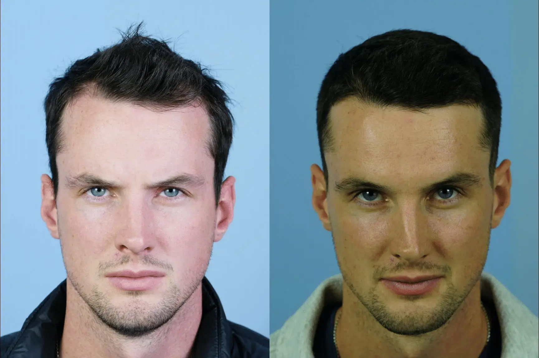 Two side-by-side headshots of a man against a light blue background. The left image shows him with short, tousled hair and a serious expression, while the right image features a similar hairstyle but with a slightly different angle and a more relaxed demeanor. Both images highlight the man's facial features, including a strong jawline and blue eyes. This comparison emphasizes subtle differences in expression and perspective, useful for discussions on facial recognition or identity.