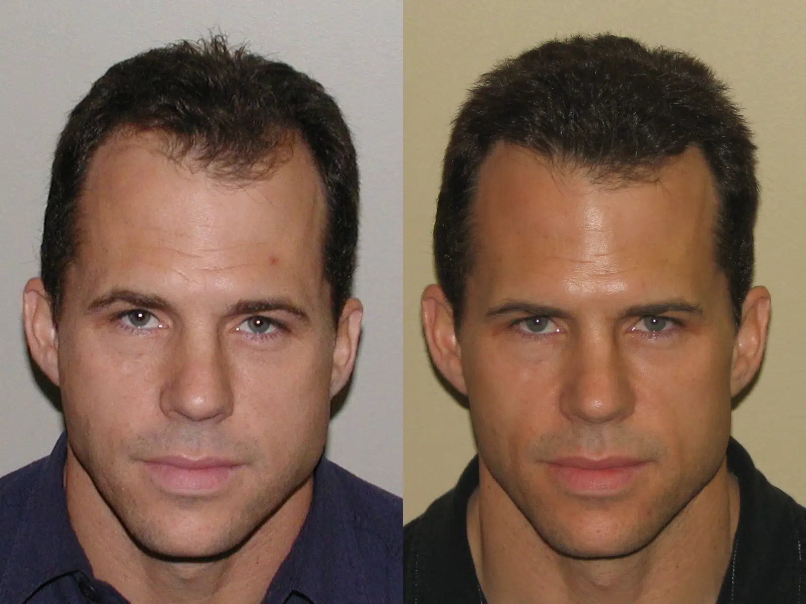 Image shows two headshot portraits of a man side by side, with contrasting backgrounds. The left image features the man in a dark shirt with a neutral expression, while the right image shows him in a lighter shirt with a slight smile. Both images highlight the man's facial features, including his short, dark hair and strong jawline. The photographs may be used for comparison purposes, such as demonstrating changes in appearance or style.