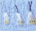 Graft Preparation