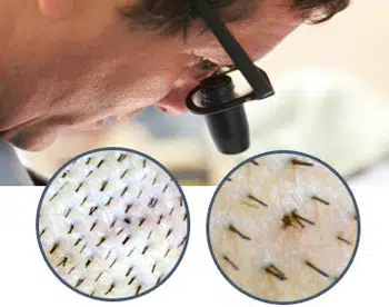 Use Magnification