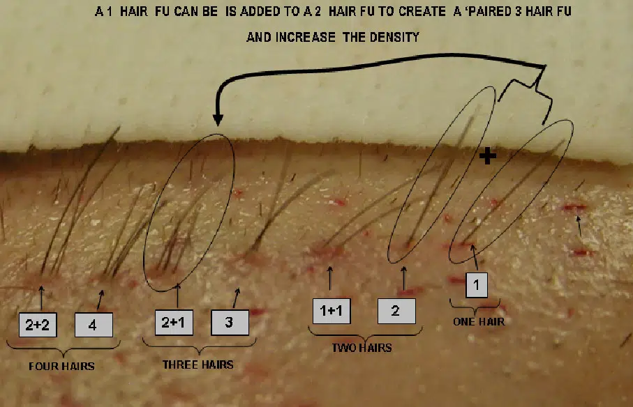 Illustration demonstrating hair density enhancement techniques. The image features labeled sections indicating various methods to add hair, including the use of hair filler to create a fuller appearance. Key points highlight the process in three steps, with numerical markers for clarity. The background shows a scalp with hair strands, emphasizing the visual impact of the techniques. This informative graphic serves as a guide for understanding how to achieve increased hair density effectively.