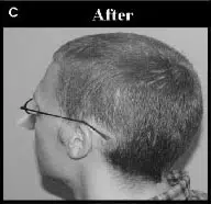 Image showing the back and side profile of a person with short hair, labeled "After." The individual is wearing glasses and has a clean, neatly trimmed haircut. The background is neutral, enhancing focus on the hairstyle. This image illustrates a transformation in appearance, likely after a haircut or grooming session, emphasizing the neatness and style of short hair. Ideal for discussions on hair care, styling tips, or before-and-after comparisons in grooming.