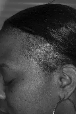 Close-up profile view of a person with natural hair styled in a sleek ponytail. The image highlights the texture and shine of the hair, as well as the contours of the head and ear. The background is neutral, emphasizing the subject's features. This image can be used to discuss hair care, styling techniques, or the beauty of natural hair.