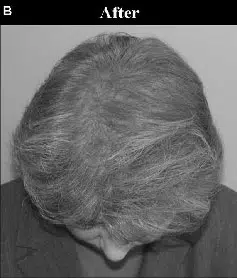 Close-up view of the top of a person's head with gray hair, showing a natural hairstyle. The individual is looking down, which emphasizes the texture and color of the hair. The image is in black and white, highlighting the contrast between the hair and the background. This visual representation is suitable for discussions about hair care, aging, or hairstyle trends.