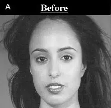 Image of a woman with long, dark hair, shown in black and white, labeled "Before." The woman has a neutral expression and is facing the camera directly. This image represents a before comparison, possibly related to a beauty or transformation process. The background is simple and unobtrusive, allowing the focus to remain on her face. This visual serves to highlight changes or improvements that may occur in subsequent images.
