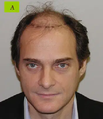 Image of a middle-aged man with short, thinning hair and blue eyes, wearing a black suit jacket over a light-colored shirt. The man is facing the camera with a neutral expression. The background is plain and light-colored, emphasizing his features. This image may be used in contexts relating to professional profiles or identity verification.