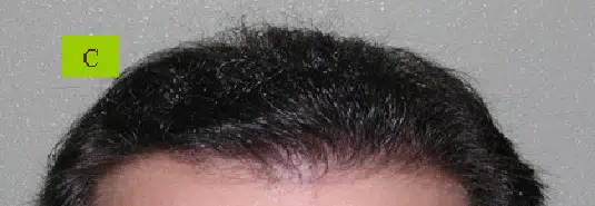 Close-up view of dark, curly hair at the crown of a person's head against a neutral background. The image focuses on the texture and volume of the hair, highlighting its natural curls. Ideal for discussions on hair care, styling techniques, or trends in curly hairstyles.