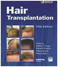 Cover of the book "Hair Transplantation, Fifth Edition," edited by Walter P. Unger, Ronald Shapiro, Robert Unger, and Mark Unger. The cover features a blue background with the title prominently displayed at the top. Below the title, there are six images showcasing various hair transplant results, illustrating different stages of hair restoration. This comprehensive guide serves as a key resource for medical professionals and individuals interested in hair transplantation techniques and outcomes. The book combines expert insights and practical information to