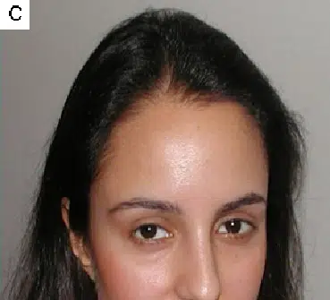 Close-up portrait of a woman with long dark hair and a neutral expression, set against a light gray background. The image focuses on her face, highlighting her features such as her brown eyes and smooth skin. The lighting is soft, creating a natural look. This image can be used in contexts related to beauty, skincare, or personal branding.