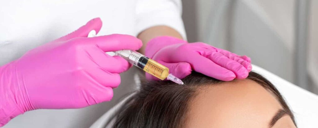 A professional wearing pink gloves administers a hair restoration treatment using a microneedling device on a client's scalp. The device is filled with a yellow serum, designed to promote hair growth and improve scalp health. This image illustrates a modern approach to hair loss solutions, emphasizing the importance of professional care in aesthetic treatments. Ideal for clinics offering hair restoration services, this visual highlights the procedure's technique and equipment, making it relevant for potential clients seeking effective hair rejuvenation options.