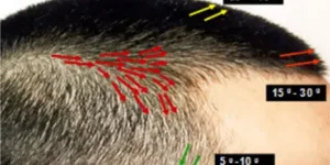 Follow normal angle and direction of hair