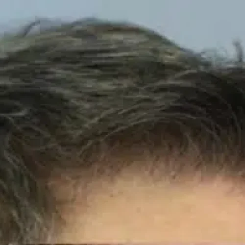 1 Year